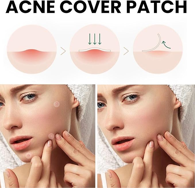 Acne Cover Patch